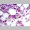 Medula osea HE 04.jpg